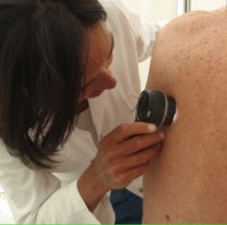 Detección de cáncer de piel En el hospital Señor del Milagro