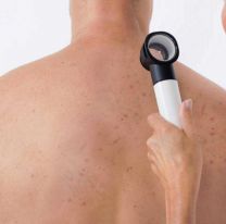 Campaña de prevención: Dermatólogos atenderán gratis y sin turno previo