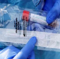 Coronavirus: Salta contar&aacute; con 1.000 reactivos