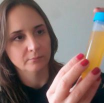 Científicas argentinas lograron un importante avance en la lucha contra el dengue