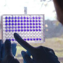 Coronavirus: cient&iacute;ficos argentinos investigan una mol&eacute;cula bovina que podr&iacute;a ser clave