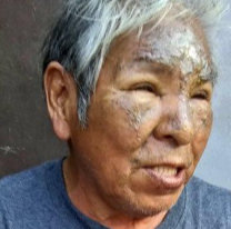 Necesita la ayuda de todos: Martín perdió su carpintería por un incendio