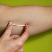 Mañana se colocarán “chips anticonceptivos” en el centro de salud del Bº Autódromo