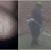 “Necesito que me operen para llevar el pan a mi casa”, el pedido de un salte&ntilde;o