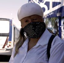 Tiene 22 años, vive con el 88% del cuerpo quemado y es una tenaz guerrera: "No le temo a la muerte"