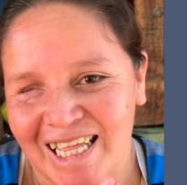 Érica, la salteña que se opera el 5 de agosto: su vida cambiará para siempre