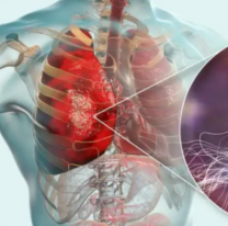 No se confirmaron casos de Legionelosis en Salta