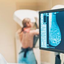 Hasta el viernes habr&aacute; mamograf&iacute;as gratuitas y sin turno previo en el San Bernardo