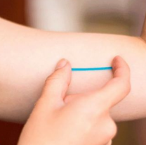 Se colocarán implantes subdérmicos en la Usina Cultural