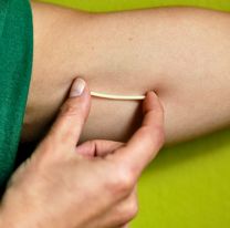 Colocar&aacute;n implantes subd&eacute;rmidos anticonceptivos gratuitos a Salte&ntilde;as 