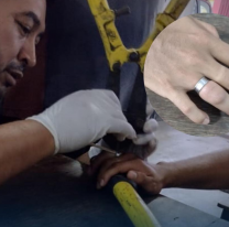 15 horas de desesperaci&oacute;n: Bomberos sacaron el anillo atorado del dedo de una joven