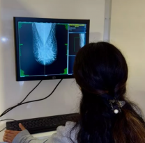 Se realizarán mamografías gratuitas en Animaná y San Carlos