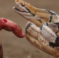 Salta registró más de 70 casos de mordeduras de víbora y piden tomar precauciones