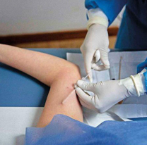 Hoy se colocarán implantes subdérmicos en la Usina Cultural