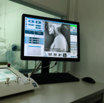El hospital San Bernardo incorpor&oacute; un nuevo seri&oacute;grafo de &uacute;ltima generaci&oacute;n